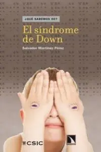 EL SÍNDROME DE DOWN EL SÍNDROME DE DOWN